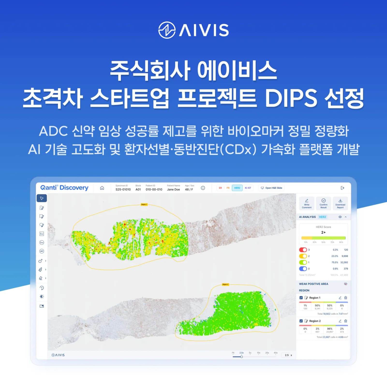 에이비스 중기부 초격차 스타트업 선정…AI 병리 분석 고도화